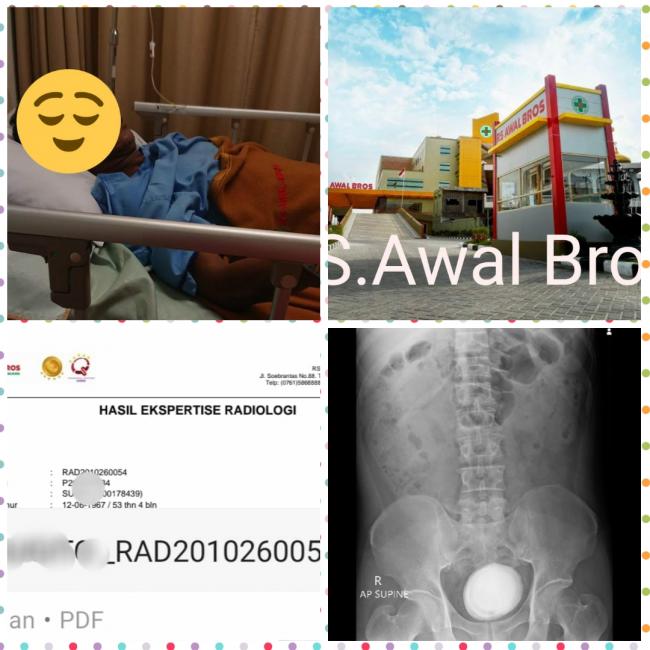 Alm SGT Pasien RS Awal Bros Penyakit Gagal Ginjal Diduga Alami Malapraktek Berujung Maut